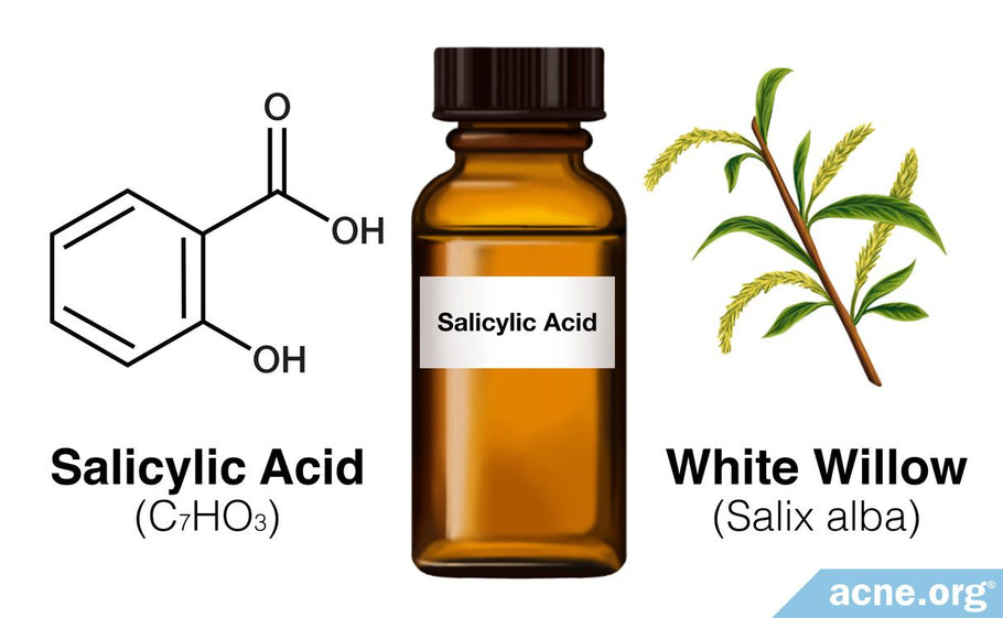 Salicylic Acid for Acne Treatment: Ingredient Spotlight